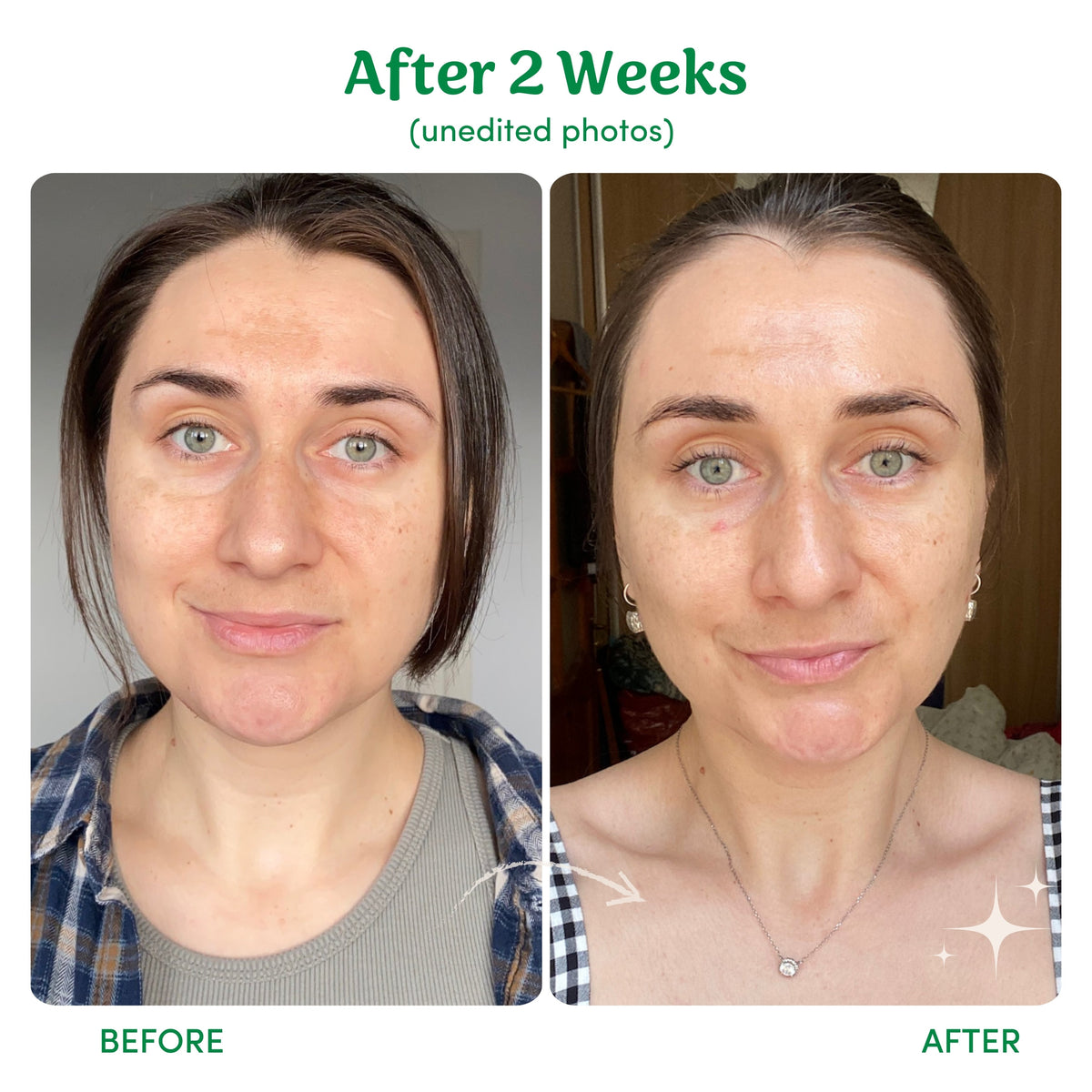 【日常健康生活】Birch Babe Golden Hour 亮肌 Vitamin C Serum | 海外代購-面部精華-FIT MART 香港智能健康及運動生活用品專門店：筋膜槍、瑜伽輔助工具、智能健身設備
